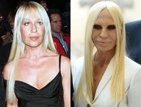 donatella versace cirugias|donatella versace before plastic surgery.